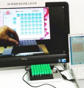 RFID qan nümunəsi toplama kartı idarəetmə həlli
