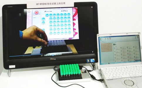 RFID qan kisəsi idarəetmə həlli 3